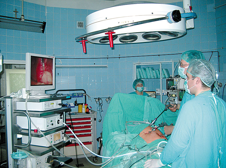 Pęcherzyk laparoskopem